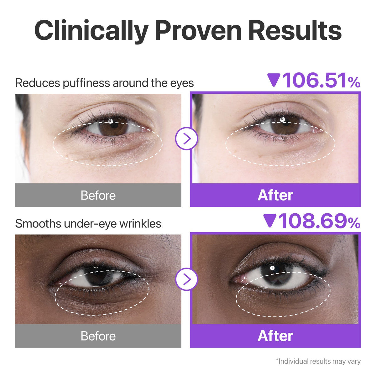 numbuzin No.9 NAD+ Collagen Under Eye Patches 8g x 5 pairs
