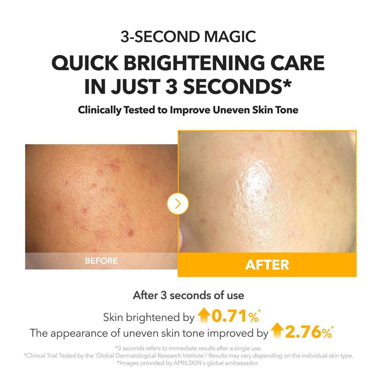 APRILSKIN A.C.E Vita Kojic Brightening Serum 110g