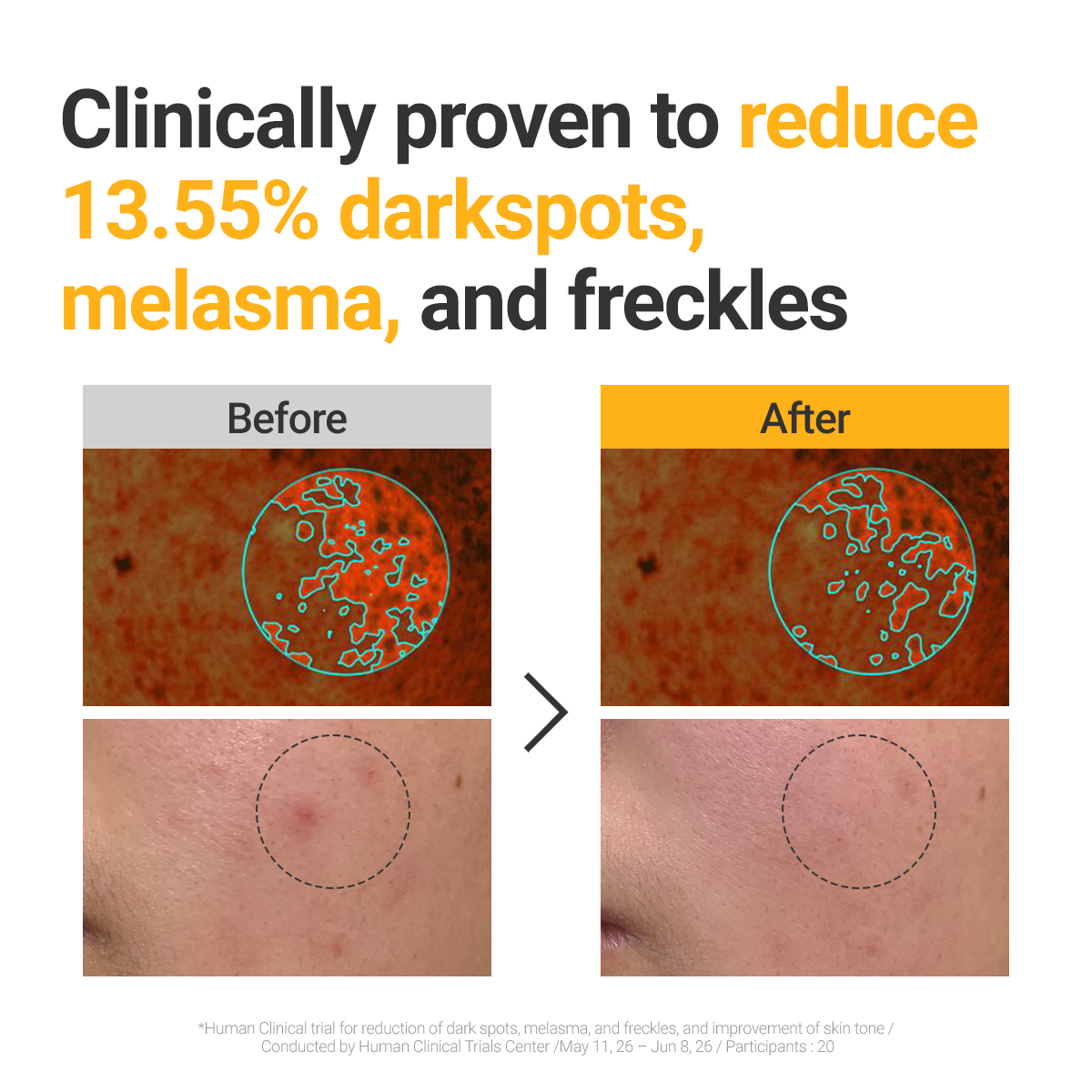 ROVECTIN Vita Dark Spot Serum Jumbo 40ml