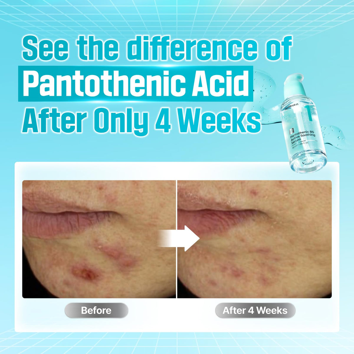 numbuzin No.1 Pantothenic B5 Active Soothing Serum 50ml