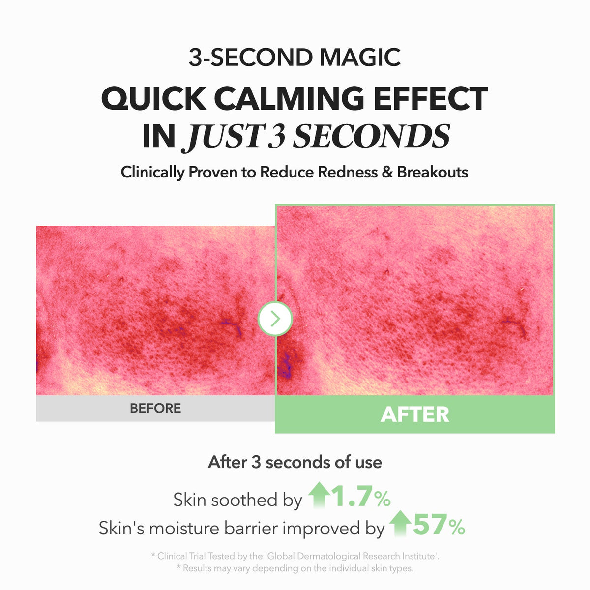 APRILSKIN A.C.E Mugwort Centella Calming Serum 110g