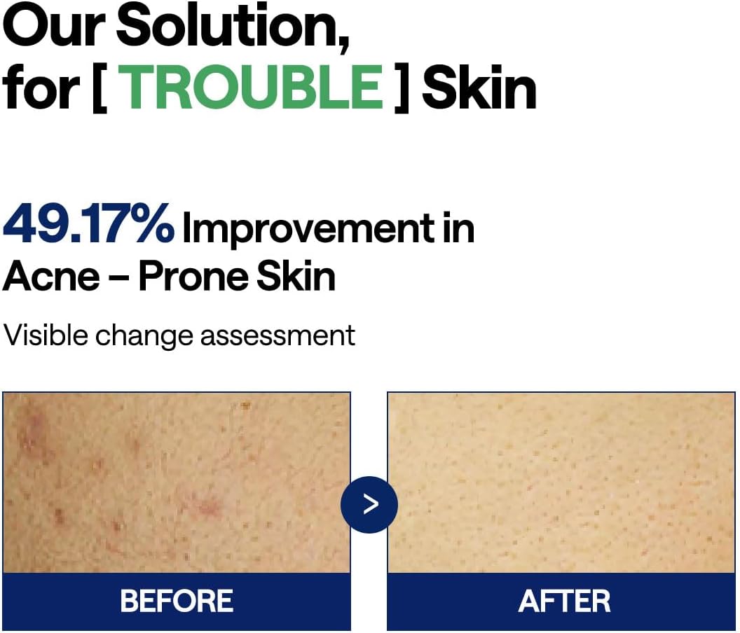 MEDIHEAL Tea Tree Trouble Pad 100 pads