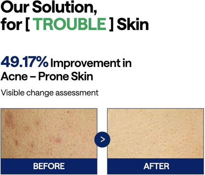 MEDIHEAL Tea Tree Trouble Pad 100 pads