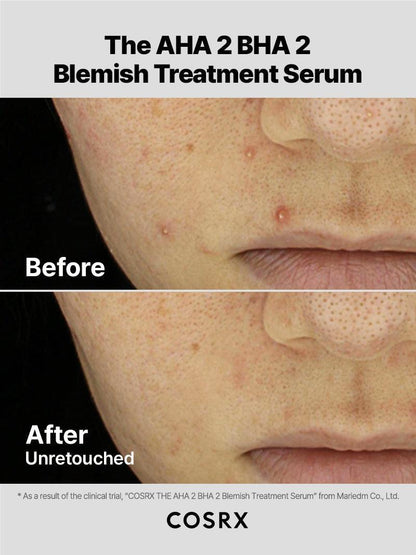 COSRX The AHA 2 BHA 2 Blemish Treatment 50g